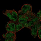 Anti-STK17B Antibody
