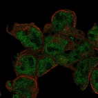 Anti-STK17B Antibody