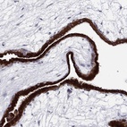 Immunohistochemical staining of human placenta shows high expression.