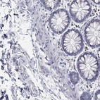 Immunohistochemical staining of human rectum shows low expression as expected.