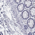 Immunohistochemical staining of human rectum shows low expression as expected.