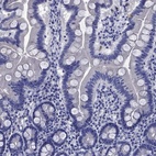 Immunohistochemical staining of human duodenum shows low expression as expected.