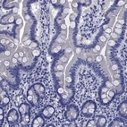 Immunohistochemical staining of human duodenum shows low expression as expected.