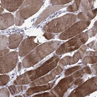 Immunohistochemical staining of human skeletal muscle shows high expression.