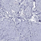 Immunohistochemical staining of human smooth muscle shows low expression as expected.