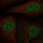 Anti-CDKN2B Antibody