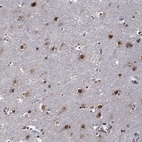 Anti-ZNF775 Antibody
