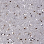 Anti-ZNF775 Antibody