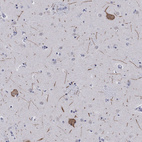 Anti-HCN4 Antibody