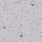 Anti-HCN4 Antibody
