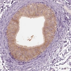 Immunohistochemical staining of human epididymis shows high expression.