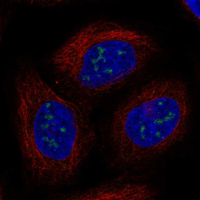 Anti-UBE2W Antibody