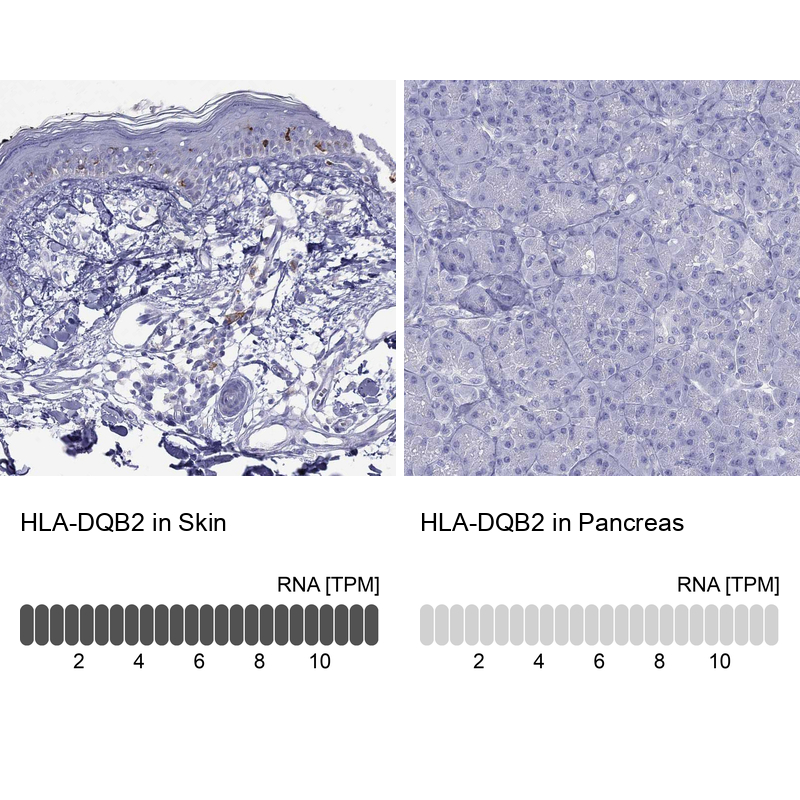 Anti-HLA-DQB2 Antibody
