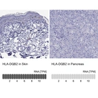 Anti-HLA-DQB2 Antibody