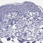 Immunohistochemical staining of human skin shows strong cytoplasmic positivity in Langerhans cells.