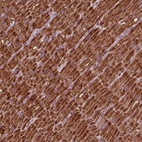 Immunohistochemical staining of human heart muscle shows high expression.