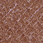 Immunohistochemical staining of human heart muscle shows high expression.