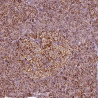 Immunohistochemical staining of human pancreas shows low expression as expected.