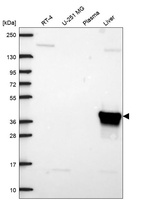 Western blot analysis in human cell line RT-4, human cell line U-251 MG, human plasma and human liver tissue.