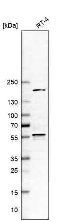 Anti-ETV3 Antibody