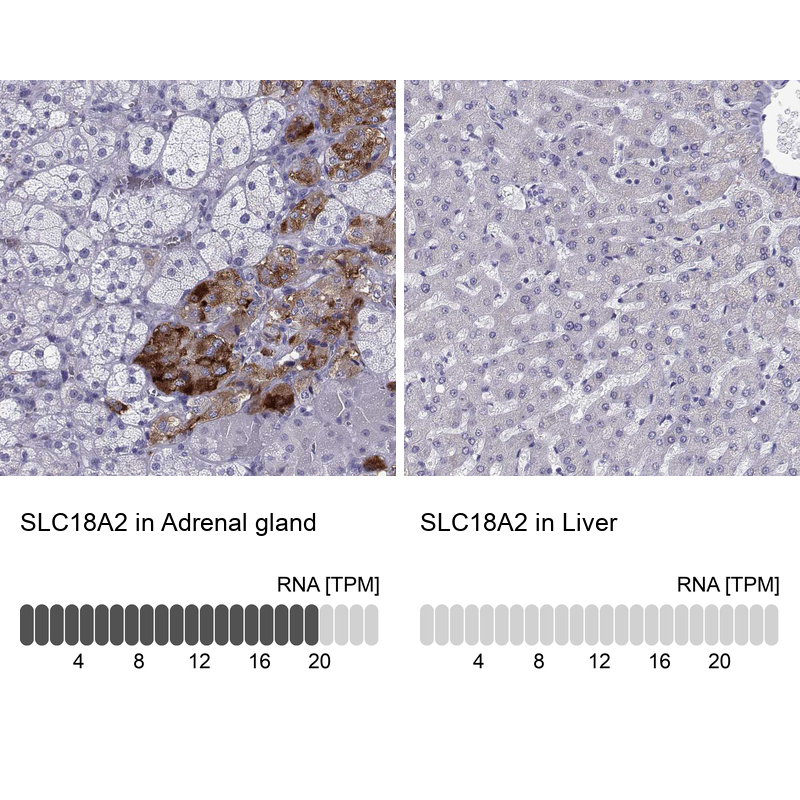 Anti-SLC18A2 Antibody