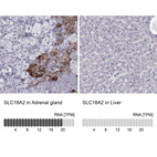 Anti-SLC18A2 Antibody