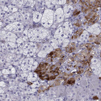 Immunohistochemical staining of human adrenal gland shows moderate cytoplasmic positivity in glandular cells.