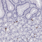 Immunohistochemical staining of human stomach shows strong cytoplasmic positivity in enteroendocrine cells.