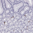 Immunohistochemical staining of human stomach shows strong cytoplasmic positivity in enteroendocrine cells.