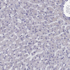 Immunohistochemical staining of human liver shows no positivity in hepatocytes as expected.