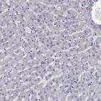 Anti-SLC18A2 Antibody
