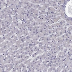 Immunohistochemical staining of human liver shows no positivity in hepatocytes as expected.