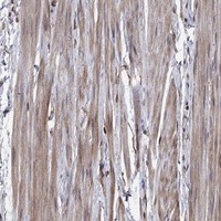 Anti-GYG1 Antibody