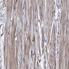 Anti-GYG1 Antibody