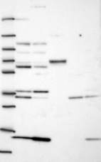 Lane 1: Marker [kDa] 250, 130, 95, 72, 55, 36, 28, 17, 10 | Lane 2: RT4 | Lane 3: U-251 MG | Lane 4: Human Plasma | Lane 5: Liver | Lane 6: Tonsil