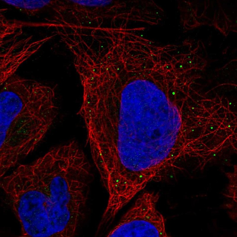 Anti-SLITRK5 Antibody