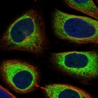 Immunofluorescent staining of human cell line SiHa shows localization to endoplasmic reticulum.