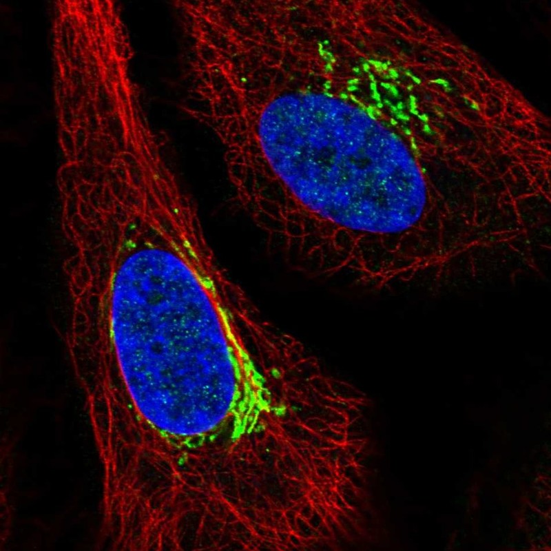 Anti-ARIH1 Antibody