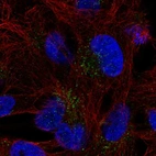 Anti-FAM78B Antibody
