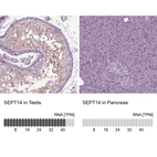 Anti-SEPT14 Antibody