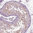 Immunohistochemical staining of human testis shows strong cytoplasmic positivity in cells in seminiferous ducts.