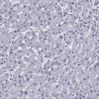 Immunohistochemical staining of human liver shows no positivity in hepatocytes as expected.