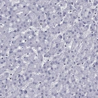 Immunohistochemical staining of human liver shows no positivity in hepatocytes as expected.