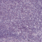 Immunohistochemical staining of human tonsil shows no positivity in non-germinal center cells as expected.