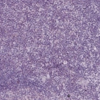 Immunohistochemical staining of human tonsil shows no positivity in non-germinal center cells as expected.