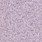 Immunohistochemical staining of human liver shows no positivity in hepatocytes as expected.