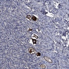 Anti-STK3 Antibody