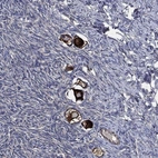 Anti-STK3 Antibody