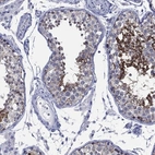 Anti-AKAP3 Antibody