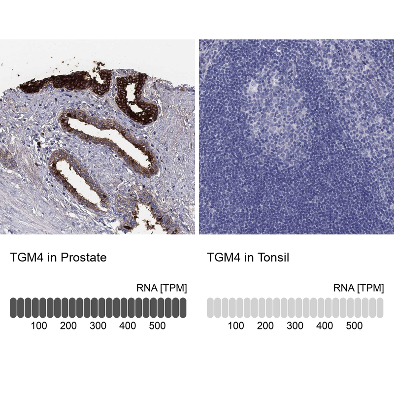 Anti-TGM4 Antibody